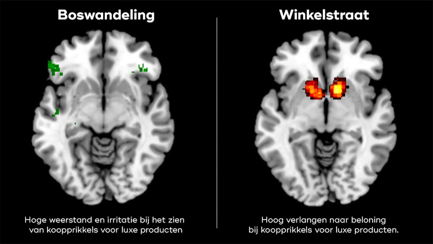 Hoe de natuur jouw brein helpt om koopprikkels te weerstaan